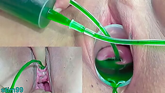 Intense Gynecological Play With Injections For Two Japanese Women In A Kinky Video